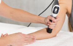 Die radiale Stoßwelle in der physiotherapeutischen Anwendung am Unterarm.